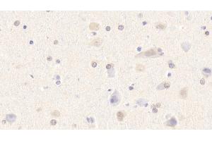 Immunohistochemistry (IHC) image for anti-Myomesin 2 (MYOM2) (AA 1130-1434) antibody (ABIN7436495)