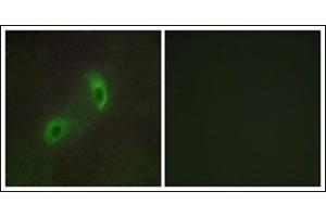 Immunofluorescence analysis of HuvEc cells, using HGS Antibody. (HGS 抗体  (Internal Region))