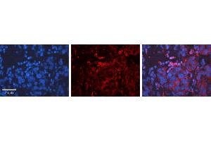 Rabbit Anti-CCND1 Antibody Catalog Number: ARP30163_P050 Formalin Fixed Paraffin Embedded Tissue: Human Liver Tissue Observed Staining: Cytoplasm, Plasma membrane Primary Antibody Concentration: 1:600 Other Working Concentrations: N/A Secondary Antibody: Donkey anti-Rabbit-Cy3 Secondary Antibody Concentration: 1:200 Magnification: 20X Exposure Time: 0. (Cyclin D1 抗体  (Middle Region))