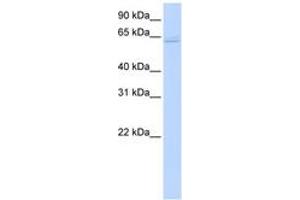 Image no. 1 for anti-TNF Receptor-Associated Factor 6 (TRAF6) (C-Term) antibody (ABIN6742184) (TRAF6 抗体  (C-Term))