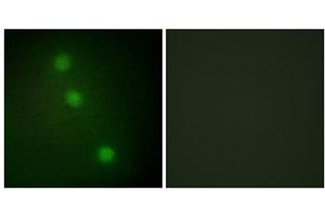 Immunofluorescence analysis of HUVEC cells, using ATF1 antibody. (AFT1 抗体  (C-Term))