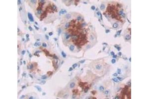 IHC-P analysis of Human Tissue, with DAB staining. (alpha Defensin 1 抗体  (AA 20-94))