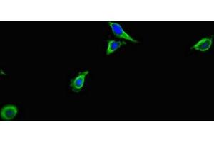 Immunofluorescent analysis of Hela cells using ABIN7143102 at dilution of 1:100 and Alexa Fluor 488-congugated AffiniPure Goat Anti-Rabbit IgG(H+L) (ACTR3 抗体  (AA 352-409))