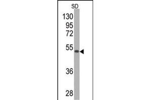 Western blot analysis of anti-SOD2 Monoclonal Antibody (ABIN387807 and ABIN2843901) by SOD2-GST fusion protein (GST MW=26 kD. (SOD2 抗体)