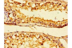 Immunohistochemistry of paraffin-embedded human testis tissue using ABIN7174530 at dilution of 1:100 (UBA6 抗体  (AA 1-44))