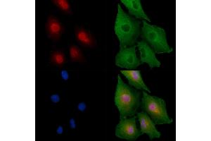 ABIN6258408 and ABIN6275691 staining  cells by IF/ICC. (ZNF420 抗体  (Internal Region))