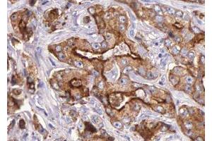 ABIN6276035 at 1/100 staining human Prostate tissue sections by IHC-P. (GPR35 抗体  (Internal Region))
