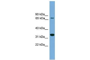 WB Suggested Anti-BCAN Antibody Titration: 0. (BCAN 抗体  (Middle Region))