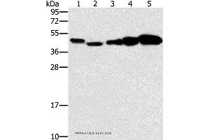 Western blot analysis of Hela, Raji, Jurkat, A549 and NIH/3T3 cell, using PPAT Polyclonal Antibody at dilution of 1:250 (PPAT 抗体)