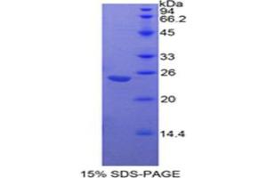 SDS-PAGE analysis of Mouse Insulin Like Growth Factor Binding Protein 7 (IGFBP7) Protein. (IGFBP7 蛋白)