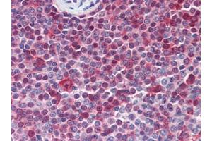 Human Spleen (formalin-fixed, paraffin-embedded) stained with PARP1followed by biotinylated goat anti-rabbit IgG secondary antibody, alkaline phosphatase-streptavidin and chromogen. (PARP1 抗体  (N-Term))