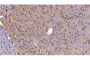 Immunohistochemistry (IHC) image for anti-DEAD (Asp-Glu-Ala-Asp) Box Polypeptide 58 (DDX58) (AA 1-211) antibody (ABIN7440305)