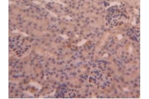 Immunohistochemistry (IHC) image for anti-Carboxypeptidase B2 (Plasma) (CPB2) (AA 187-327) antibody (ABIN7438001)