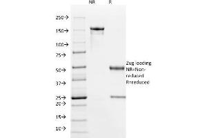 SDS-PAGE Analysis Purified HPV-16 Mouse Monoclonal Antibody (HPV16/1295). (HPV16 抗体)