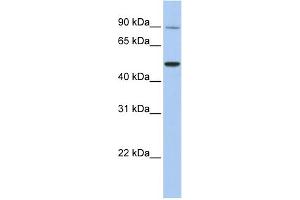 WB Suggested Anti-TRPV5 Antibody Titration:  0. (TRPV5 抗体  (N-Term))