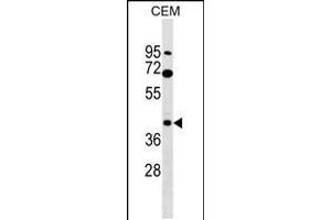 Western blot analysis in CEM cell line lysates (35ug/lane). (CACNG3 抗体  (N-Term))