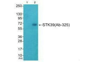 Western blot analysis of extracts from HeLa cells (Lane 2), using STK39 (Ab-325) antiobdy. (STK39 抗体  (Ser325))