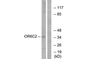Western blot analysis of extracts from HT-29 cells, using OR6C2 Antibody. (OR6C2 抗体  (AA 231-280))