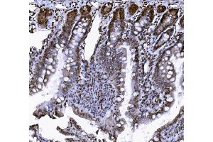 IHC analysis of VCP using anti-VCP antibody (ABIN7599605).