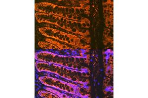 Immunofluorescence (IF) image for anti-ADAM Metallopeptidase Domain 15 (ADAM15) antibody (ABIN7265434)