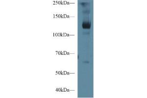 Western blot analysis of Pig Skeletal muscle lysate, using Human LIFR Antibody (1 µg/ml) and HRP-conjugated Goat Anti-Rabbit antibody ( (LIFR 抗体  (AA 692-833))