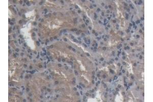 Immunohistochemistry (IHC) image for anti-Amiloride Binding Protein 1 (Amine Oxidase (Copper-Containing)) (ABP1) (AA 210-301) antibody (ABIN7437725)