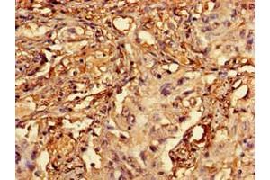Immunohistochemistry (IHC) image for anti-Regulator of Chromosome Condensation (RCC1) and BTB (POZ) Domain Containing Protein 2 (RCBTB2) (AA 1-200) antibody (ABIN7167421)