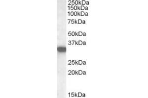 ABIN238619 (0. (HADH 抗体  (Internal Region))