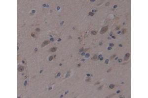 Used in DAB staining on fromalin fixed paraffin- embedded brain tissue (AHRR 抗体  (AA 1-182))