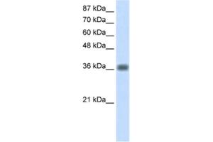Western Blotting (WB) image for anti-Kelch Domain Containing 8A (KLHDC8A) antibody (ABIN2462280) (KLHDC8A 抗体)