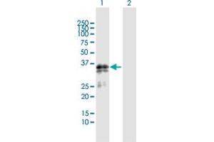 Western Blot analysis of SGCG expression in transfected 293T cell line by SGCG MaxPab polyclonal antibody. (SGCG 抗体  (AA 1-291))