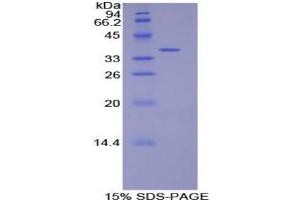 SDS-PAGE analysis of Rat Defensin beta 2 Protein. (beta 2 Defensin 蛋白)