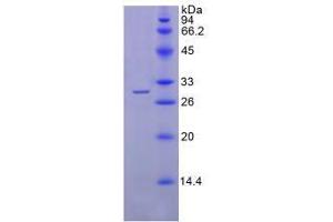 SDS-PAGE analysis of Human SGPL1 Protein. (SGPL1 蛋白)