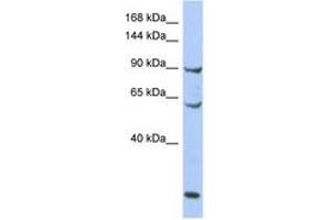 Image no. 1 for anti-Minichromosome Maintenance Deficient 8 (MCM8) (AA 71-120) antibody (ABIN6742713) (MCM8 抗体  (AA 71-120))