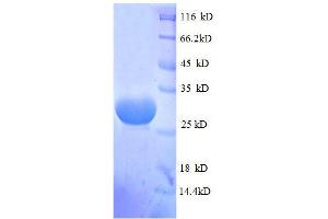 50S Ribosomal Protein L33 (AA 2-54), (partial) protein (GST tag)