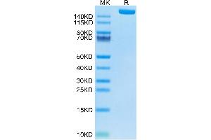 LY75/DEC-205 Protein (AA 28-1666) (His tag)