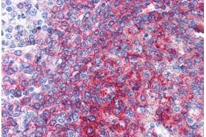 Human Spleen (formalin-fixed, paraffin-embedded) stained with CD40 antibody ABIN337317 at 10 ug/ml followed by biotinylated anti-mouse IgG secondary antibody ABIN481714, alkaline phosphatase-streptavidin and chromogen. (CD40 抗体)
