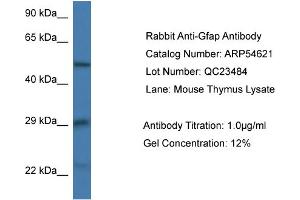 Western Blotting (WB) image for anti-Glial Fibrillary Acidic Protein (GFAP) (N-Term) antibody (ABIN785700) (GFAP 抗体  (N-Term))