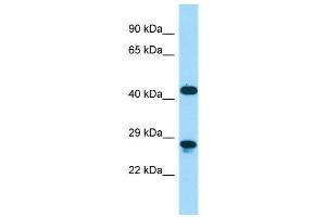 Host:  Rabbit  Target Name:  Dmbx1  Sample Type:  Mouse Stomach lysates  Antibody Dilution:  1. (DMBX1 抗体  (C-Term))