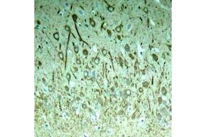 Immunohistochemical analysis of paraffin-embedded rat hippocampal region tissue from a model with Alzheimer (MAPT 抗体  (pThr231))
