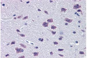 Mouse Brain: Formalin-Fixed, Paraffin-Embedded (FFPE) (DMBX1 抗体  (AA 176-225))