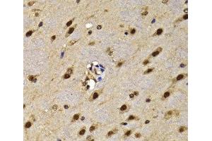 Immunohistochemistry of paraffin-embedded Mouse brain using HMG20A Polyclonal Antibody at dilution of 1:100 (40x lens). (HMG20A 抗体)
