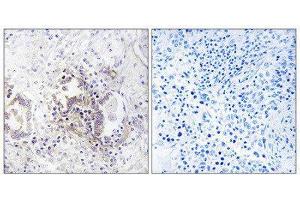 Immunohistochemistry (IHC) image for anti-Choroideremia-Like (Rab Escort Protein 2) (CHML) (Internal Region) antibody (ABIN1851922) (CHML 抗体  (Internal Region))