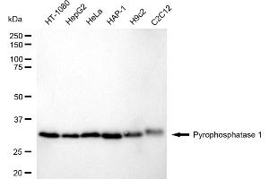 Western blotting analysis using Pyrophosphatase 1 antibody (ABIN7800077). (Recombinant Pyrophosphatase (Inorganic) 1 (PPA1) 抗体)
