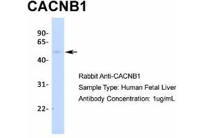 Host:  Rabbit  Target Name:  CACNB1  Sample Type:  Human Fetal Liver  Antibody Dilution:  1. (CACNB1 抗体  (N-Term))