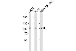 Western blot analysis of lysates from A431, Hela, MDA-MB-453 cell line (from left to right), using EPHB1 Antibody (H970) at 1:1000 at each lane. (EPH Receptor B1 抗体  (C-Term))