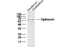 OPTN 抗体  (AA 341-440)