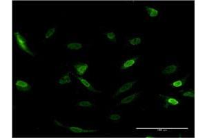 Immunofluorescence of monoclonal antibody to CDC2L6 on HeLa cell. (CDK19 抗体  (AA 367-467))