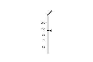 Anti-PRDM16 Antibody (Center) at 1:2000 dilution + Jurkat whole cell lysate Lysates/proteins at 20 μg per lane. (PRDM16 抗体  (AA 771-804))
