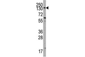 Western Blotting (WB) image for anti-Phosphoinositide-3-Kinase, Catalytic, alpha Polypeptide (PIK3CA) (AA 504-533) antibody (ABIN3028924)